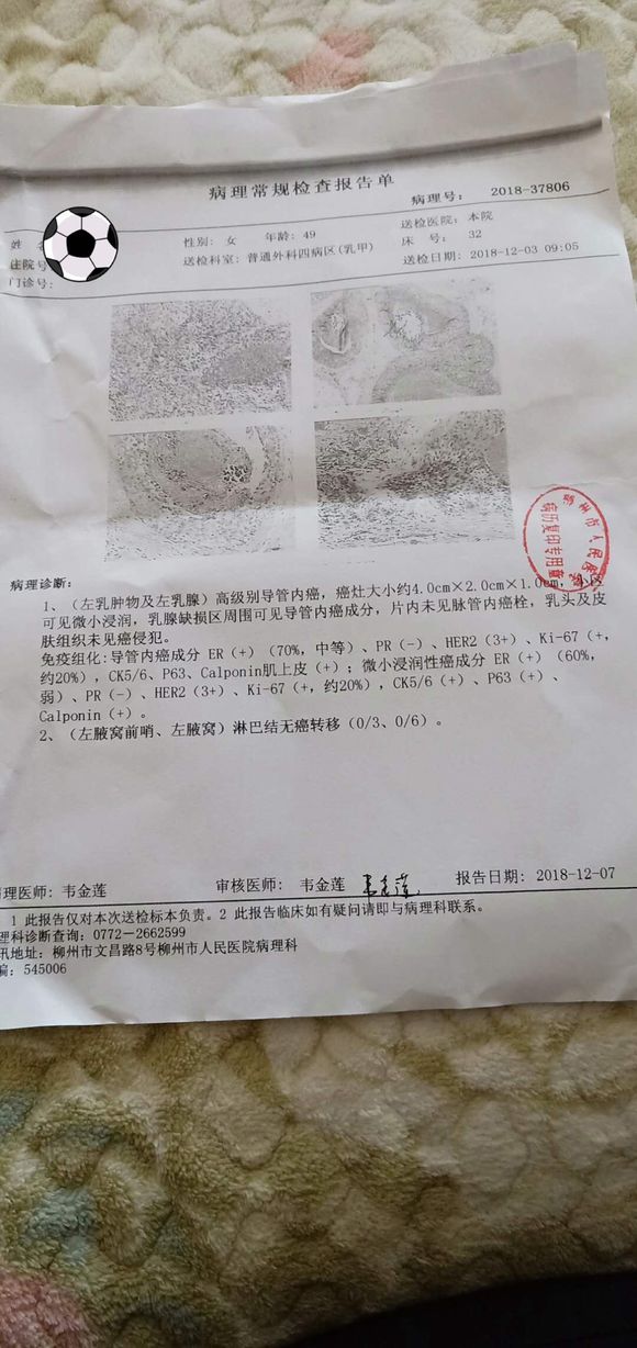 我妈妈乳腺癌早期已经手术把乳腺切除这是后面复查的结果