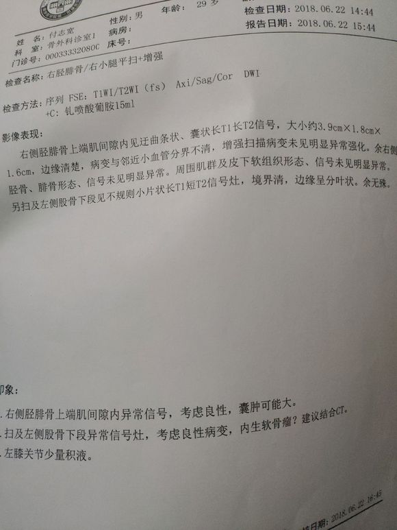 大家看看我的情况需要治疗吗？1图是软骨瘤2图是囊肿