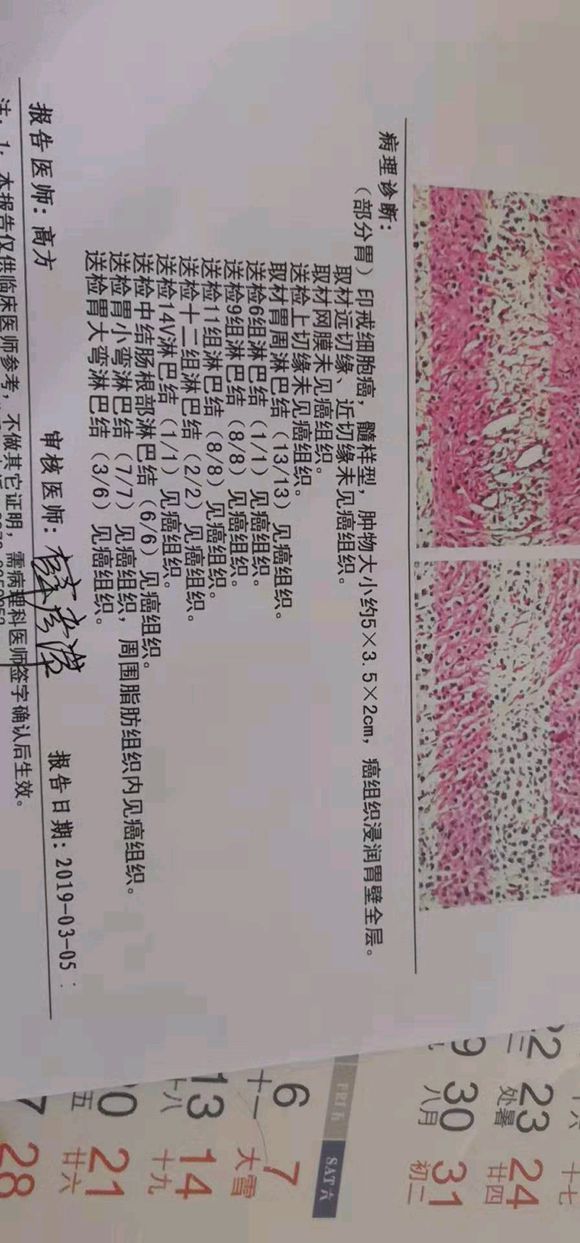 我父亲45岁胃癌印戒细胞癌。