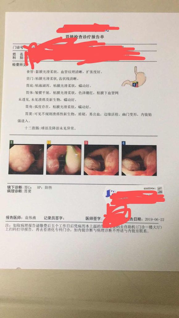 医院诊断是胃癌晚期，麻烦大家帮我看看行吗